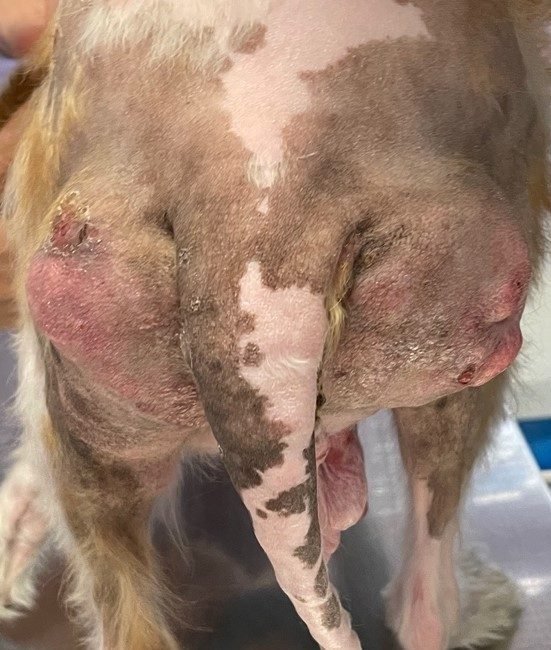 Cushing iatrogen - calcinosis cutis