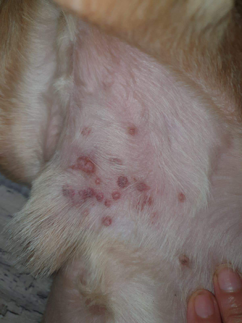 Figura 3. Dermatită lichenoidă psoriaziformă indusă de ciclosporină