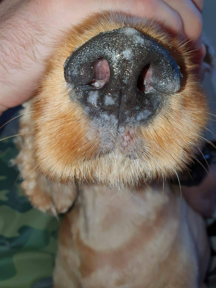 Figura 5. histiocitoză reactivă cutanată - „clown nose” . Sub tratament cu ciclosporină