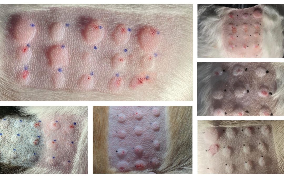 Întrebări frecvente legate de testarea intradermică de alergeni