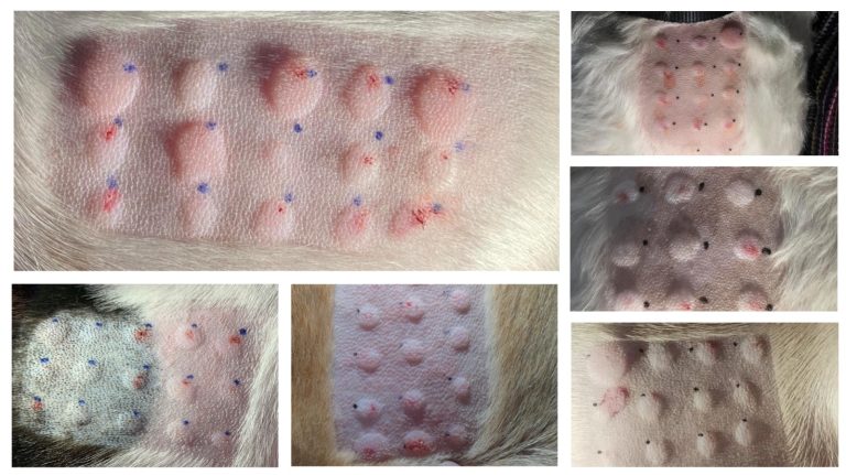 Întrebări frecvente legate de testarea intradermică de alergeni