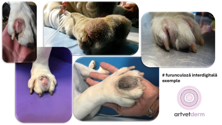 Furunculoza interdigitală (Chisti interdigitali, noduli interdigitali, chisti foliculari, furunculi)